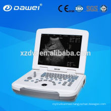 Full-Digital 96 element convex laptop ultrasonic diagnostic machine& laptop ultrasound DW-500